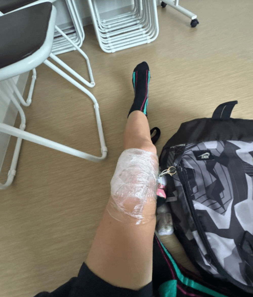 靭帯損傷かと思ったら…医師「骨に何かできている」その後選手として絶望した病気。夢に向けた思いを聞いた