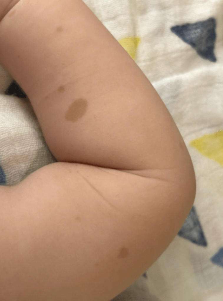 まだら症の症状①（＠coyote_1925さんより提供）