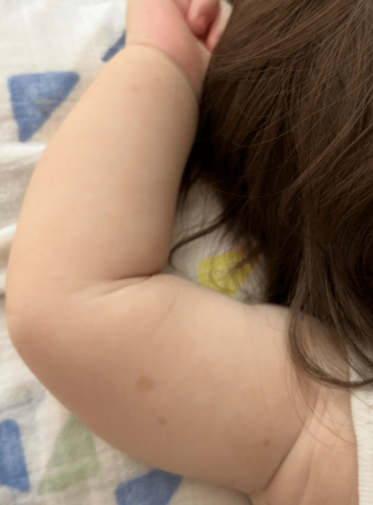 まだら症の症状②（＠coyote_1925さんより提供）