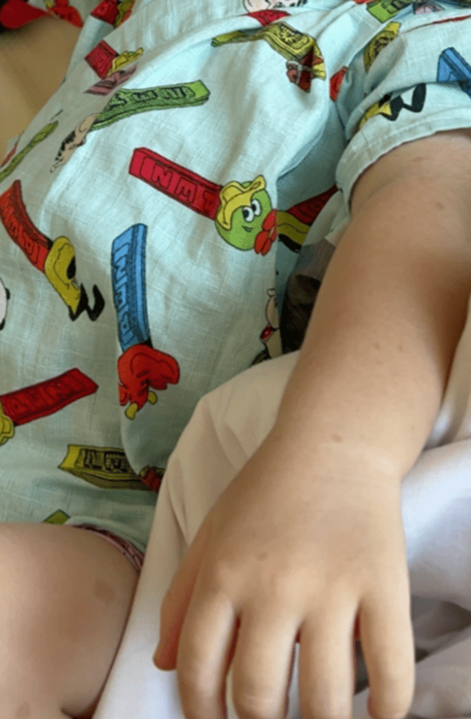 まだら症の症状③（＠coyote_1925さんより提供）