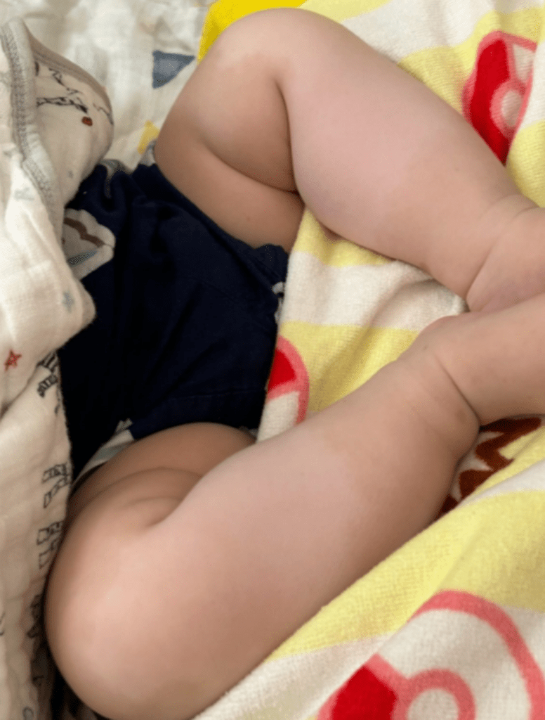 まだら症の症状④（＠coyote_1925さんより提供）