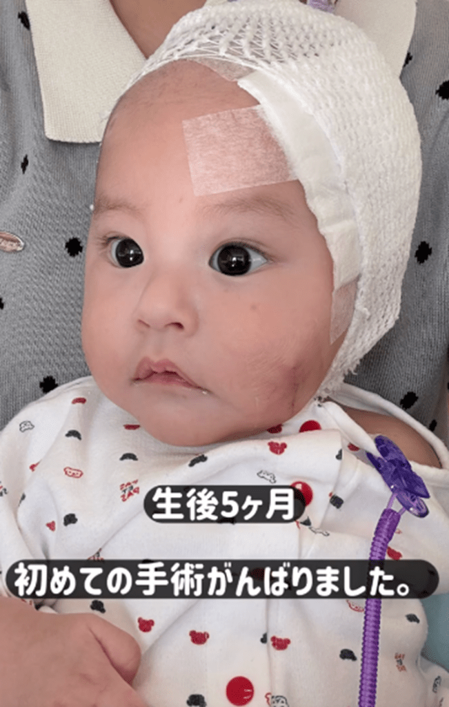 手術後①（@pin_chan_72さんより提供）