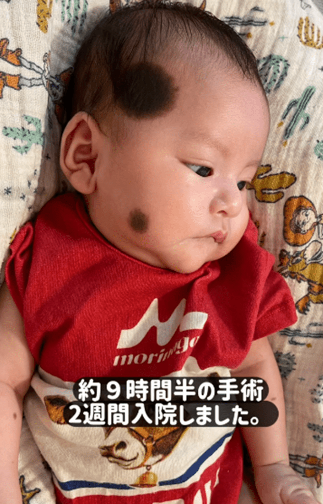 手術後②（@pin_chan_72さんより提供）
