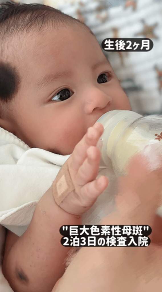 検査入院時（@pin_chan_72さんより提供）