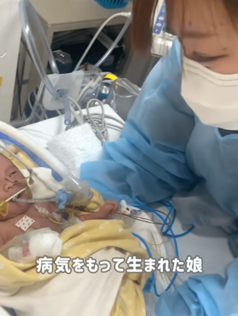 難病を抱えて生まれてきた娘さん（@mi_nosuke10さんより提供）