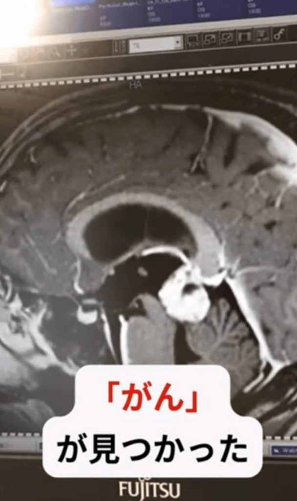 がんと診断（＠cancerfighter.rjさんより提供）