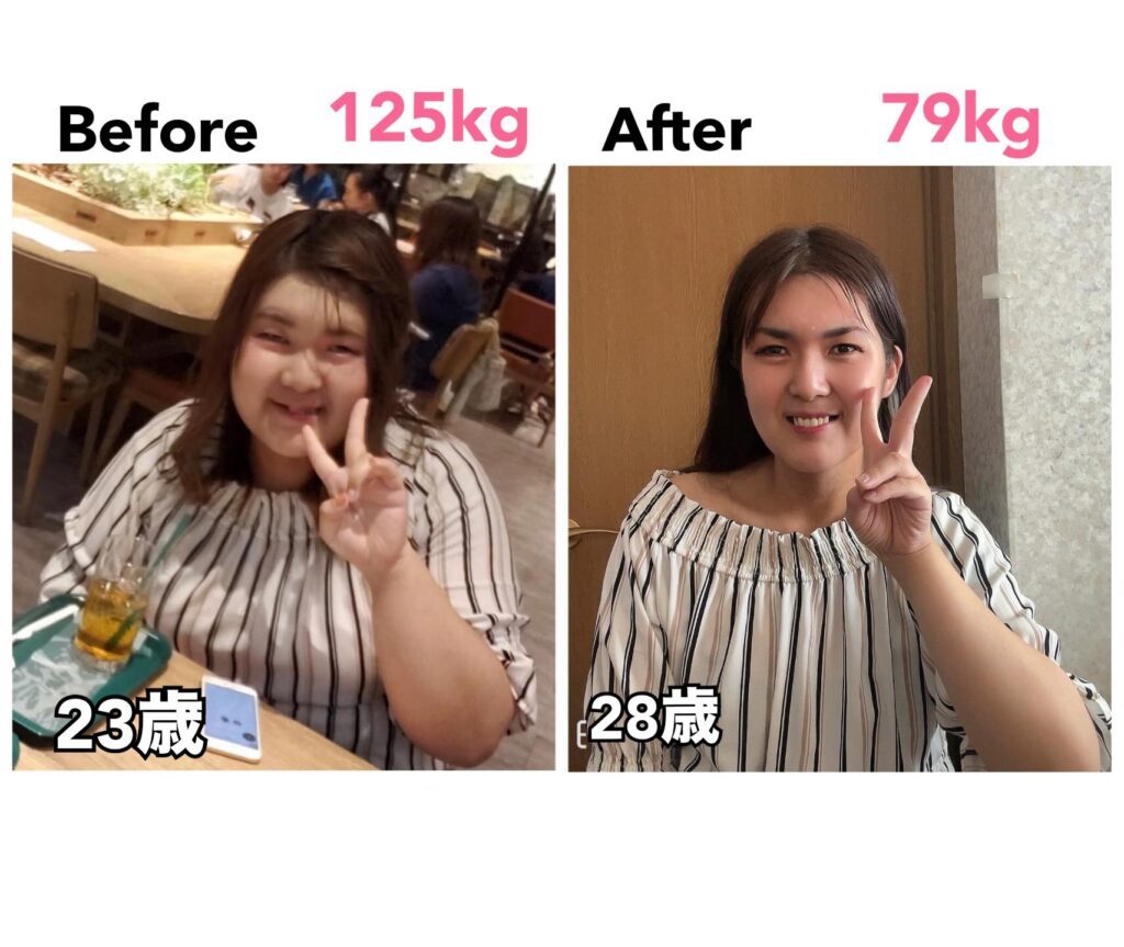 ビフォーアフター①（＠saachan1108さんより提供）