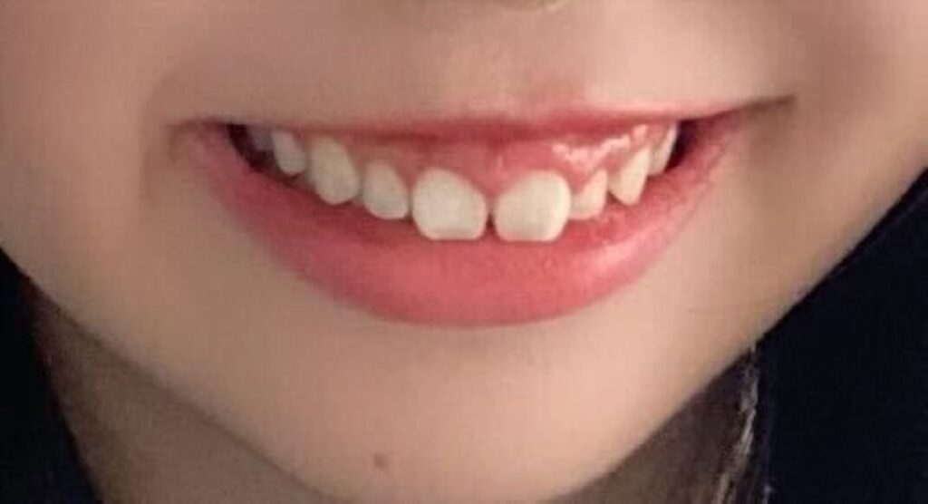 口元①（＠_o4.uyu_さんより提供）