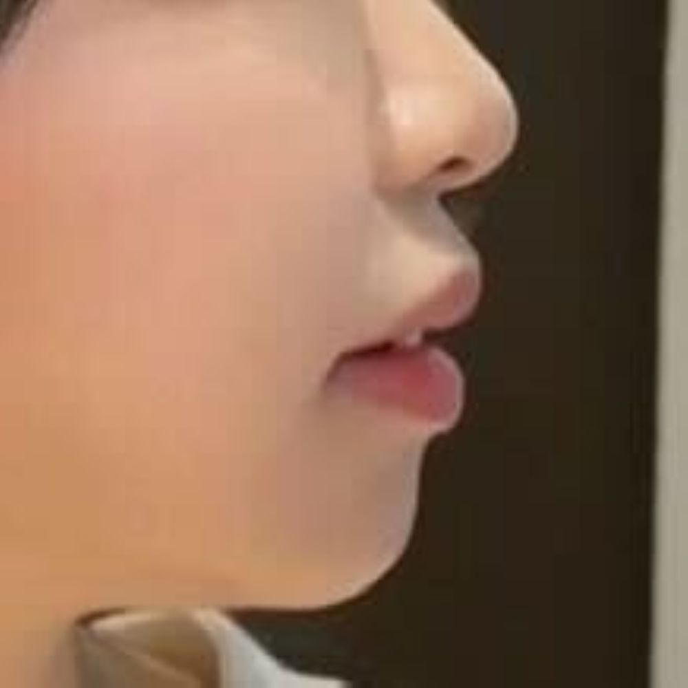 口元②（＠_o4.uyu_さんより提供）