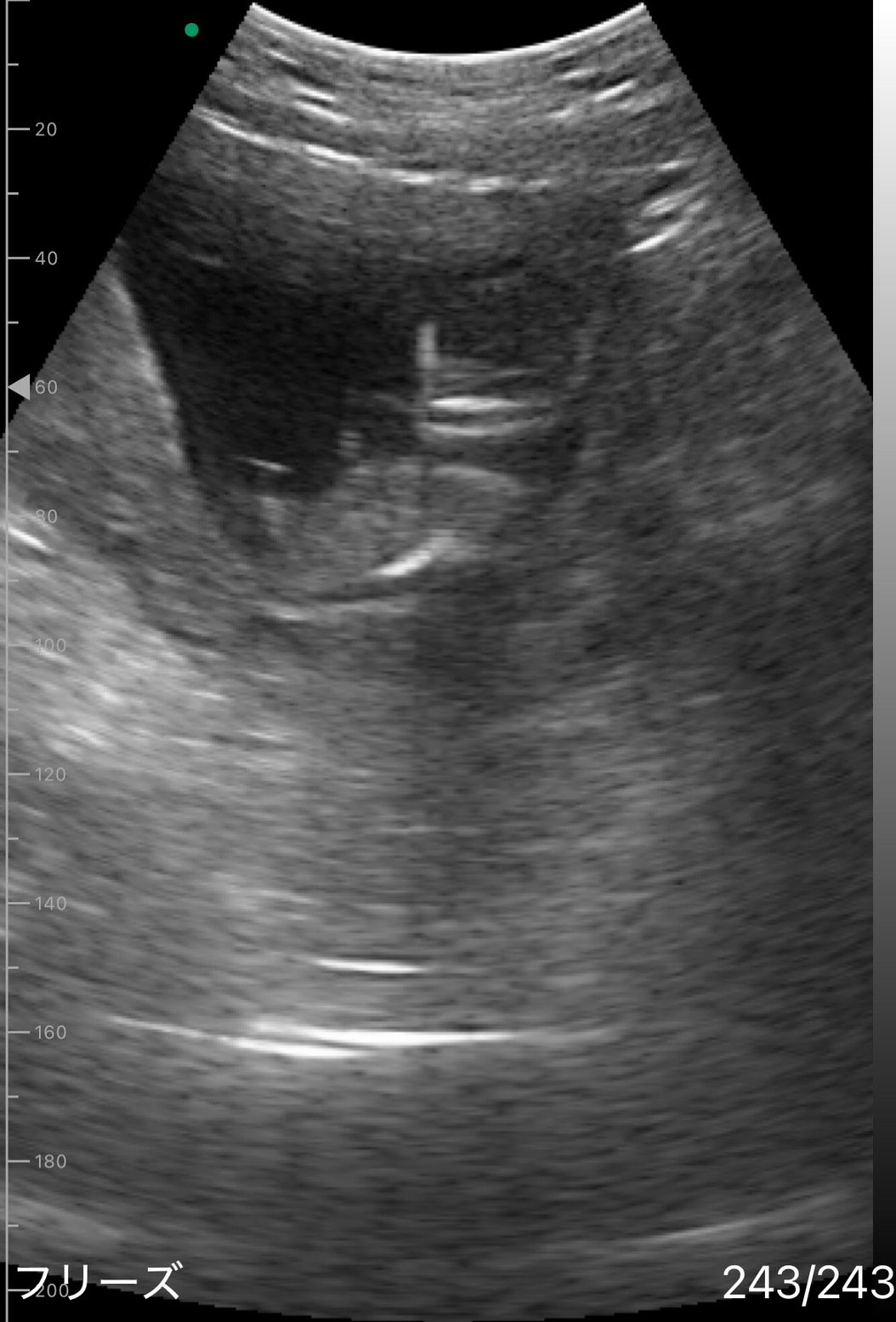 妊娠13週のエコーを見ていたママ。しかし直後、目撃したまさかの光景に「お腹のなかから親孝行ですね！！」「ファンサ」「こりゃ凄い」