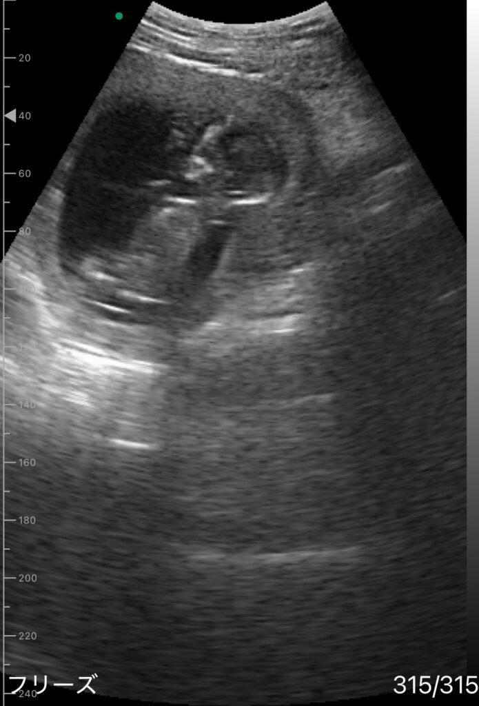 エコー写真②（＠iiyl_llyiさんより提供）
