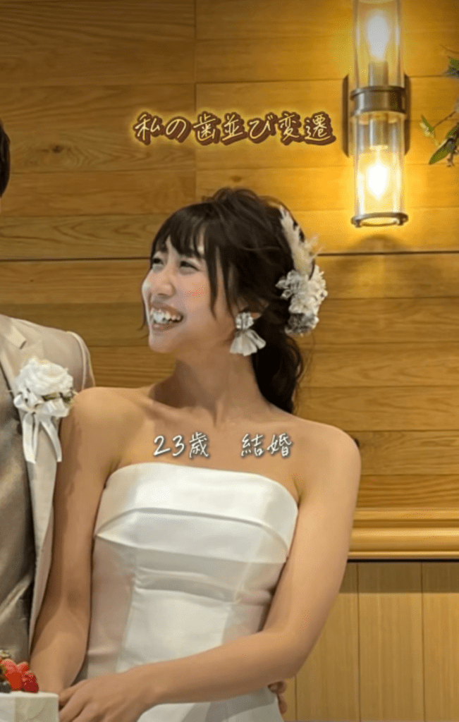 歯科矯正前②（＠gameeee_chanさんより提供）