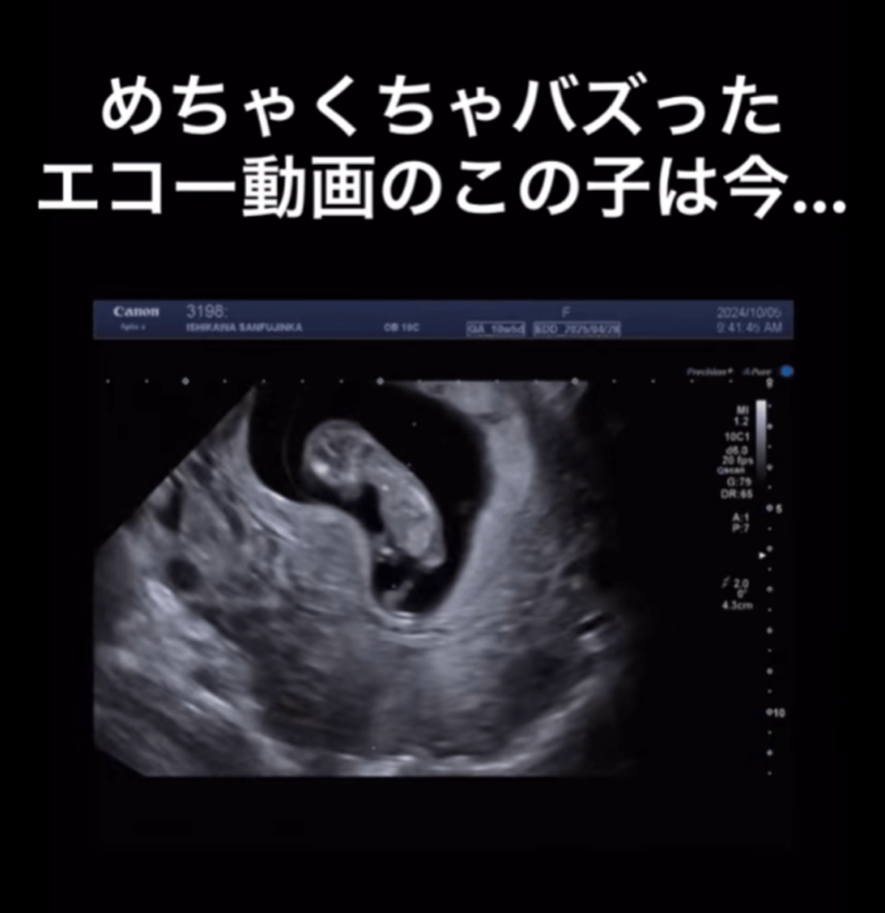 【実際の写真】　現在の様子