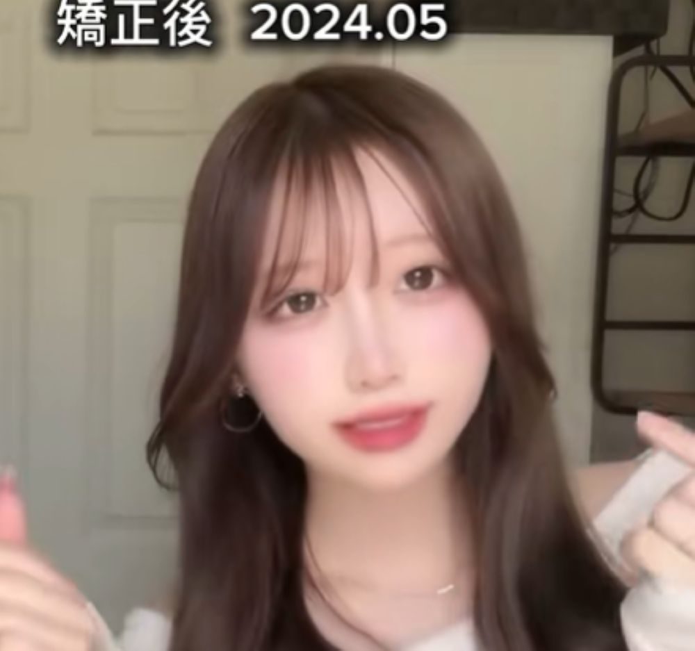 矯正後②（＠_o4.uyu_さんより提供）