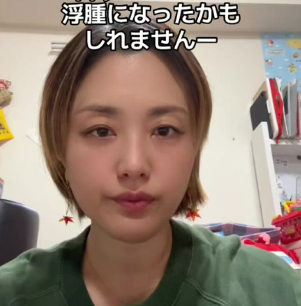 現在の症状について話す様子①（＠lisa.197851さんより提供）