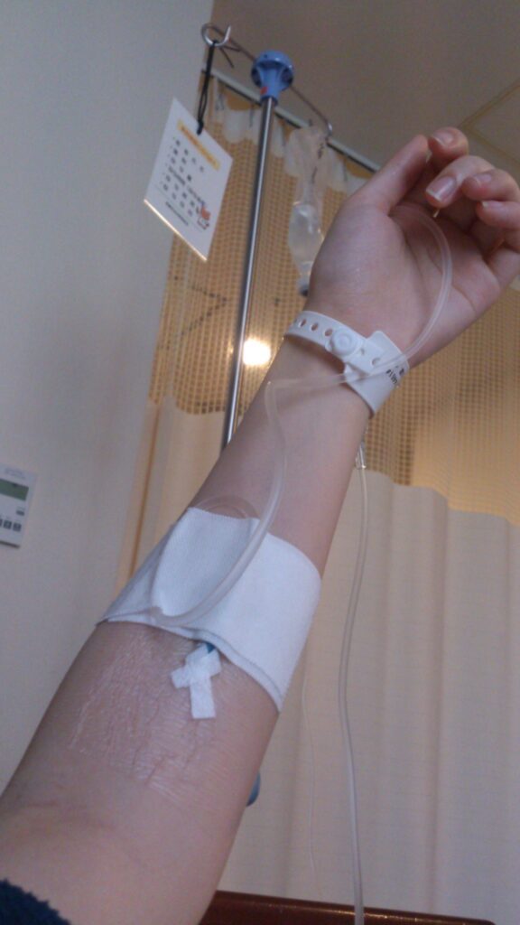 ステロイドパルス療法（＠mogu_puku.tさんより提供）