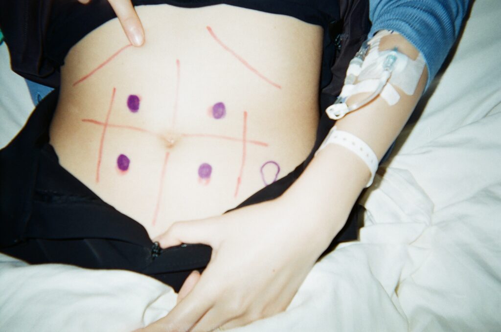 大腸がんの手術前日（＠film_by_monaさんより提供）