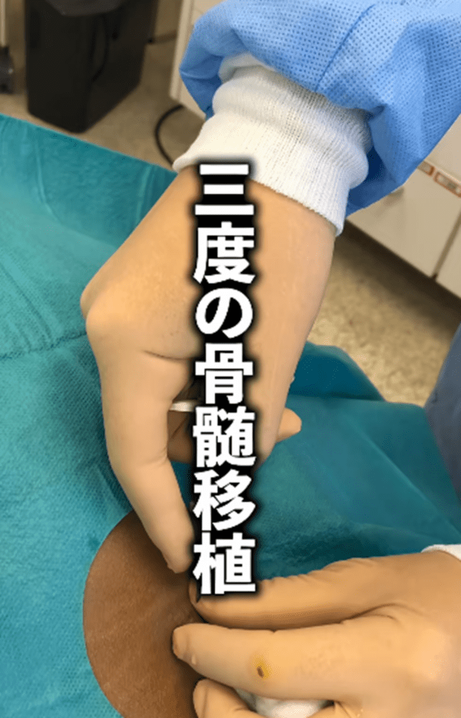 3度の骨髄移植（@natsumu.wellness.labさんより提供）
