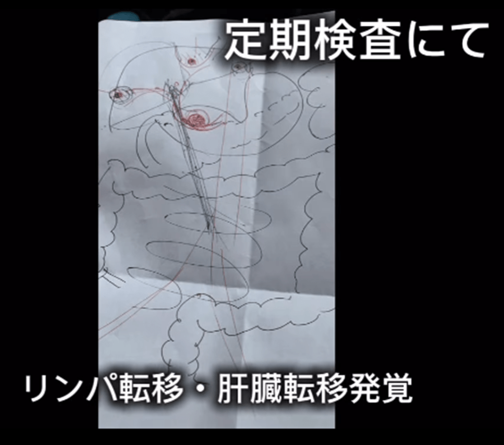 転移（福森さんより提供）