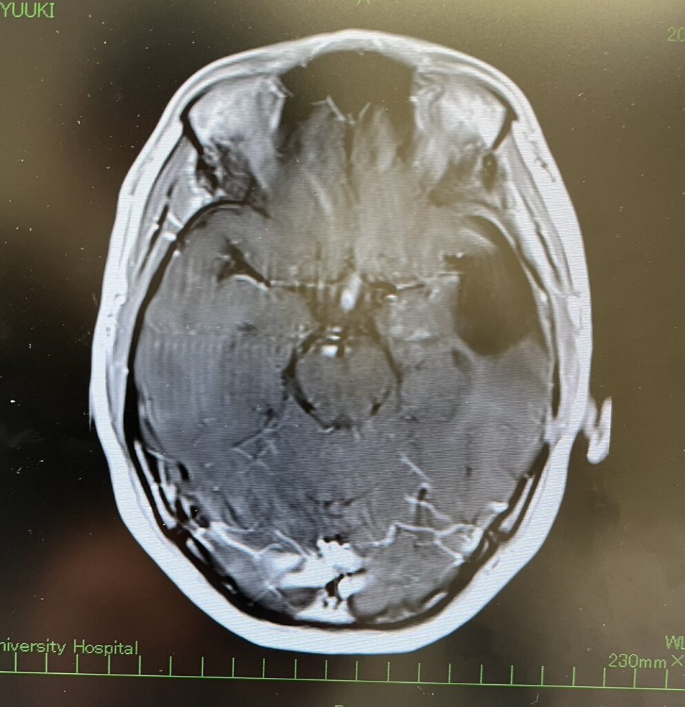 【実際の写真】　現在の様子
