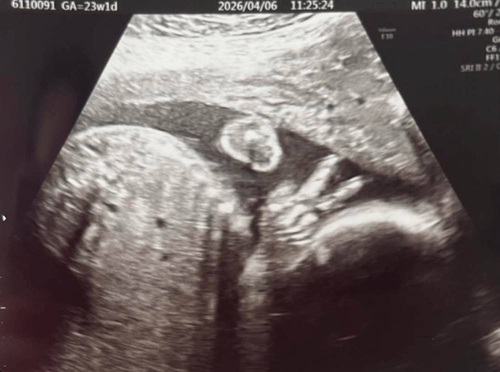 エコーの写真（@hair_story.jpさんより提供）