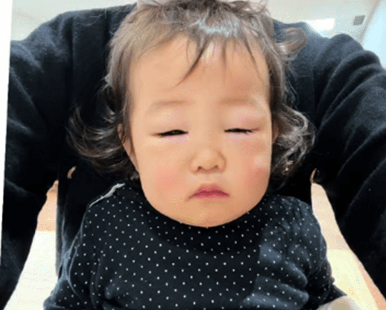 ある日、娘の目に違和感。→病院へ連れて行くと…医者「即入院です」1歳7ヶ月の娘が診断された病名と、母の思いに迫る