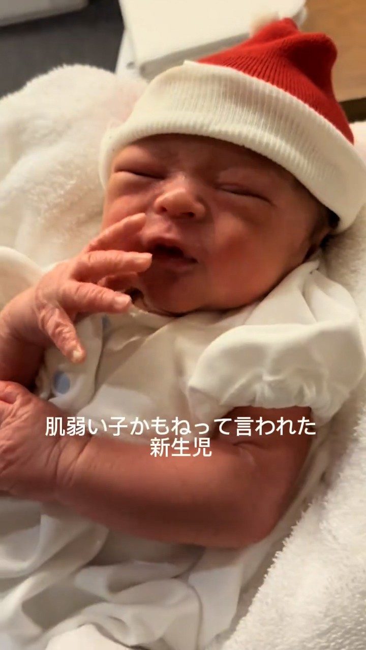 「肌弱い子かも」助産師に言われた新生児。毎日保湿を続けた4ヶ月後の姿に「素晴らしい努力！」と称賛の声