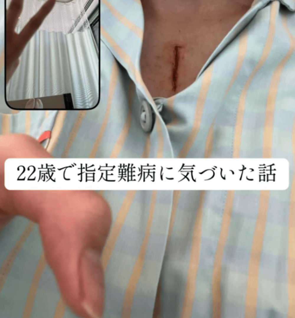 「なんか目が乾くな…」自分の体調に違和感。→しかしその後、医師「心臓の手術をしました」職場で意識を失い『命の危機』も訪れた病に驚愕。