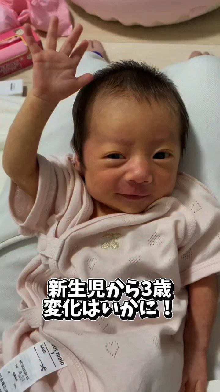 出産後「ベビーヨーダ」と言われていた赤ちゃん。→3年後の現在の姿に「可愛すぎる」「美少女」
