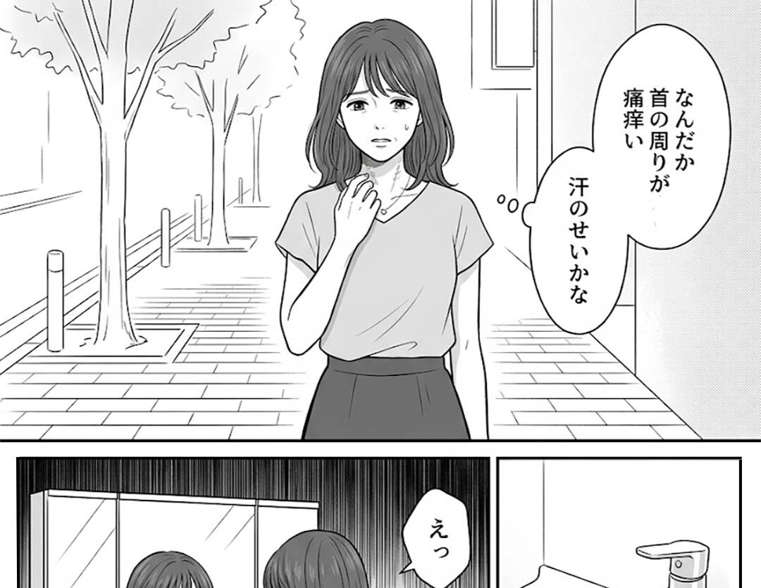 女性「なんか首がかゆいな…」放置した結果…「えっ！？」まさかの事態に「こわっ」「とにかく驚きとショック」「知らなかった」