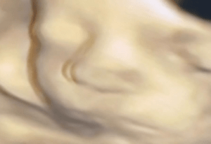 エコー写真と変わらない姿で生まれてきた赤ちゃん→成長した現在の様子に…「美形！！」「整ってる」「鼻がそのまま！」「本当に同じ顔！」