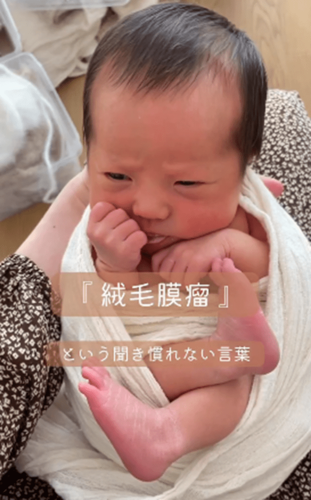 「絨毛膜瘤」との診断（＠sachiko_ikujiさんより提供）