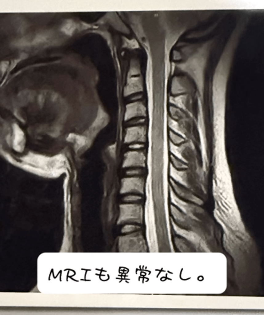 MRIも異常なし（＠ai.invisible.hopeさんより提供）