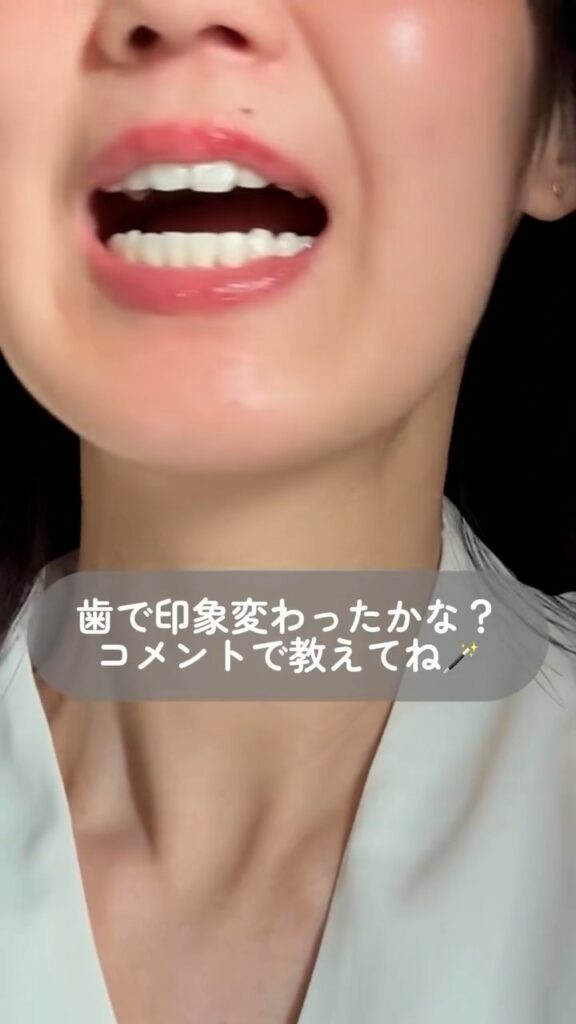 矯正後の様子④（＠nana_beautylife39さんより提供）