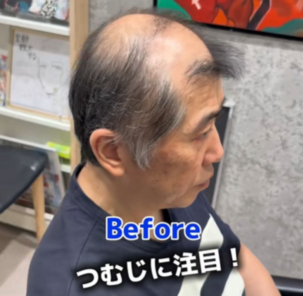 施術の様子⑦（＠oono.cutさんより提供）