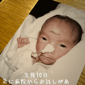 生まれてきたわが子に違和感。その後、医師「お話があります」判明した病に…「頭が真っ白に」→20年後、母に話を聞いた