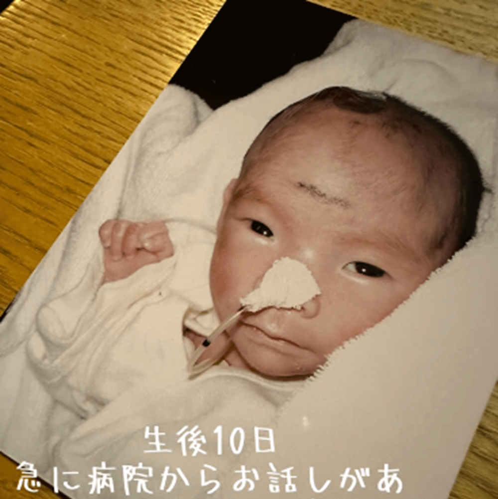 生後10日で、突然…医者「お話があります」緊急オペに…判明した病に衝撃→20年後、現在の様子に迫る