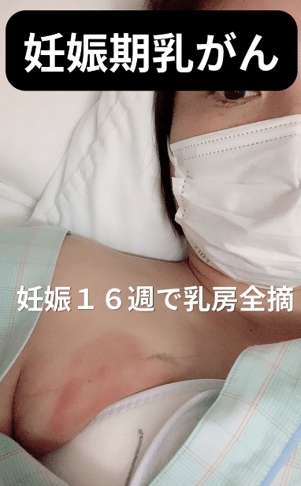 2021年、医師に「乳がんです」と告知された翌日に”妊娠”が判明→その後、5年たった現在に迫る