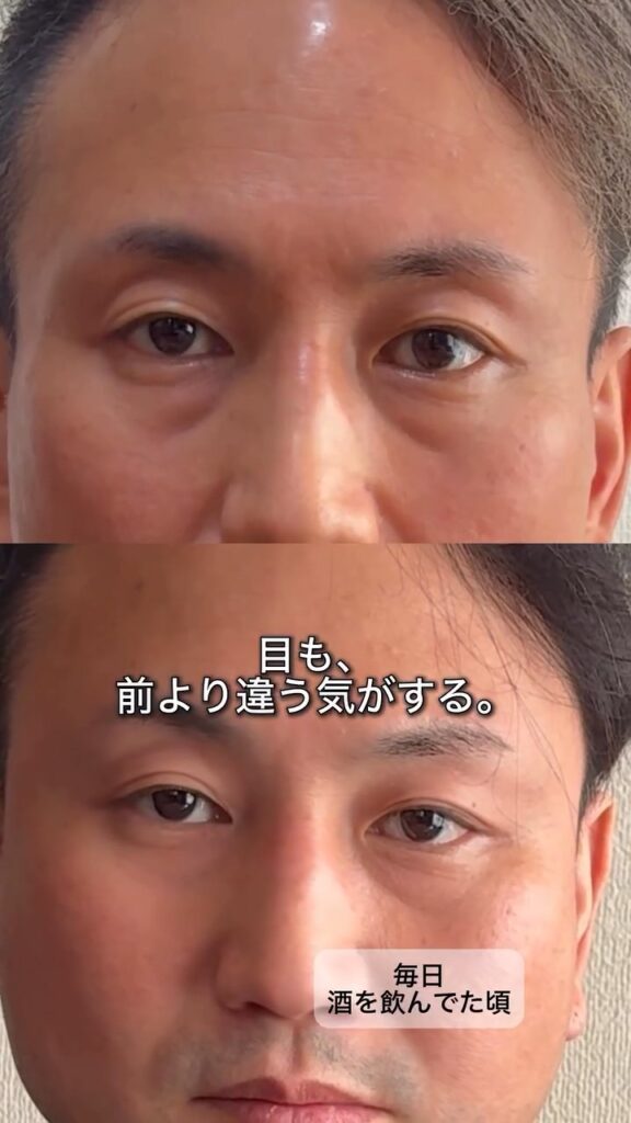 禁酒前後の比較③（＠katori_vlogさんより提供）