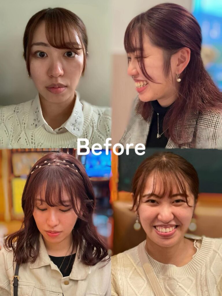 矯正を始める前の様子（＠marii_beauty_さんより提供）